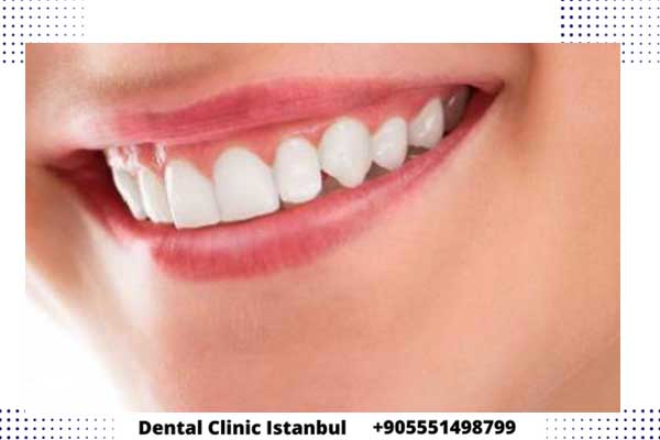تجميل الاسنان في تركيا – أسعار أفضل عيادة أسنان في اسطنبول